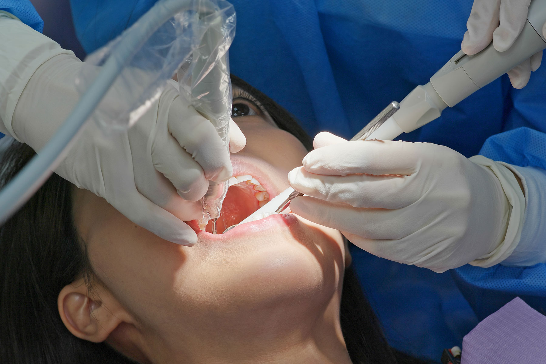 Is a Root Canal Painful Person finding out that a root canal is not painful