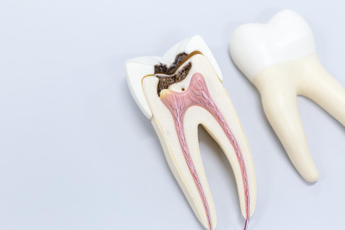 how to prevent tooth infections