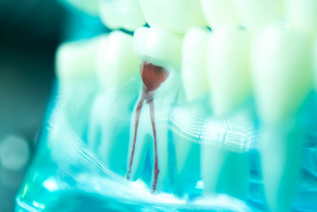 See through shot of teeth roots