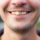 Man smiling with discolored front tooth discolored from hidden crack
